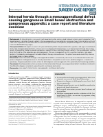 internal_hernia_through_a_mesoappendiceal_defect_causing_copy.pdf